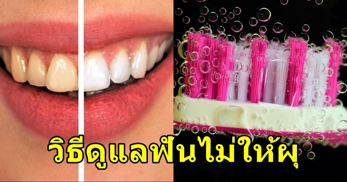 วิธีป้องกันฟันของคุณไม่ให้ผุ