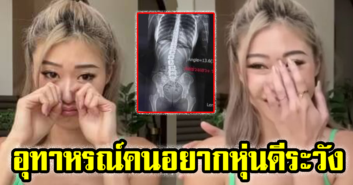 ยิปซี คีรติ ร้องไห้ เผย ฟิล์มเอ็กซเรย์ แชร์อุทาหรณ์ คนอยากหุ่นดีระวัง