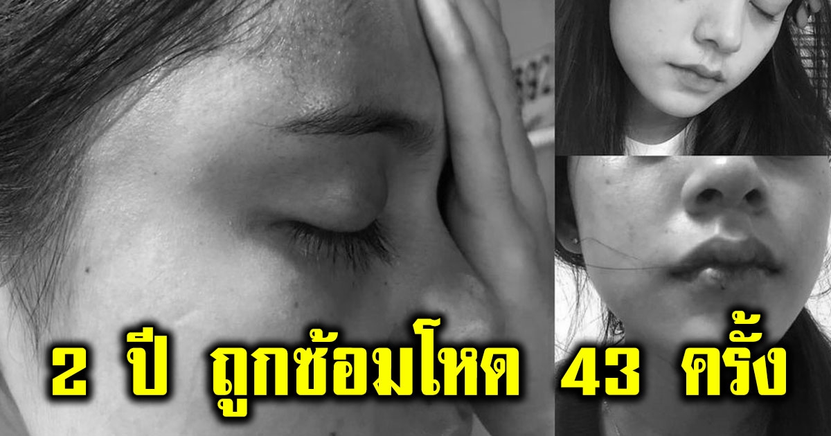 น่วมไปทั้งตัว สาววัย 17 โพสต์แฉ คบแฟนหนุ่มแค่ 2 ปี ถูกซ้อมโหด 43 ครั้ง