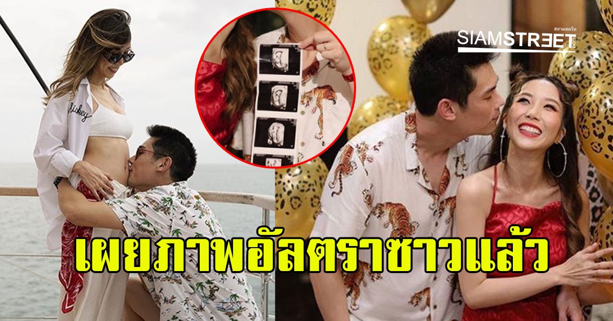 กันต์ พลอย เผยภาพอัลตร้าซาวบุตรครั้งแรก